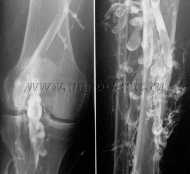 اسکن سونوگرافی